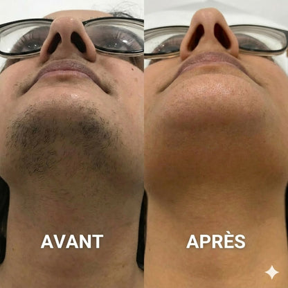 Crème Douce Et Indolore Pour L’élimination Des Poils Du Visage