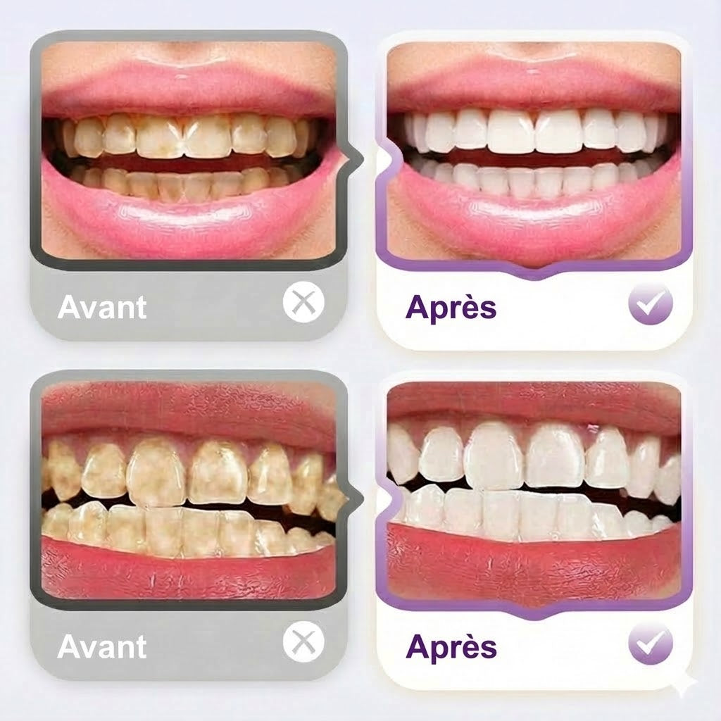 Dentifrice éclaircissant et anti-taches au lysozyme