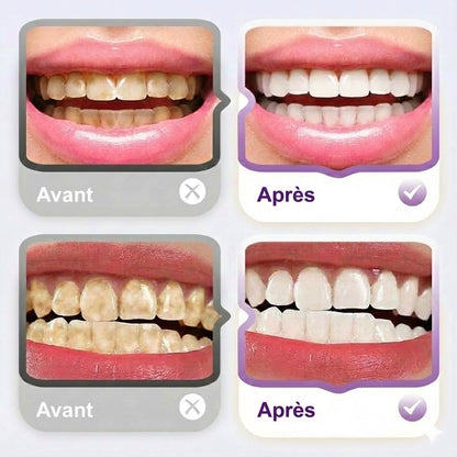 Dentifrice éclaircissant et anti-taches au lysozyme