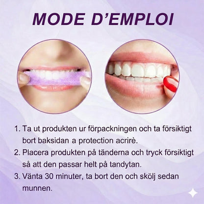 Bandes de blanchiment des dents